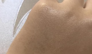 维e涂脸有什么功效 维E涂脸有什么功效