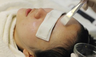 如何改善面部红血丝 如何改善面部红血丝现象