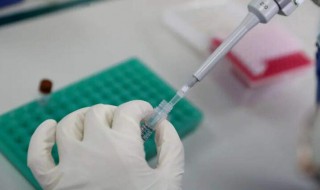 核酸检测前后注意什么 核酸检测前后注意什么问题