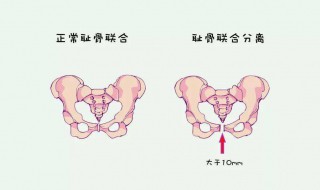 耻骨在哪个位置（人体耻骨在哪个位置）