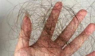 防脱发小窍门（如何改善脱发）