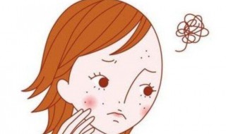 怎样祛除青春痘 怎么去除青春痘