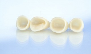 烤瓷牙种类 金属烤瓷牙种类