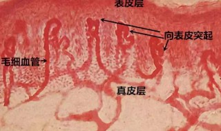 如何消除红血丝 如何消除红血丝眼睛