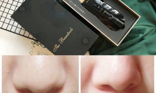 黑头一直不挤会怎样（黑头粉刺怎么样才能彻底根除）