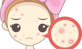 痘印怎么去除最有效 痘印怎么去除最有效的方法男生