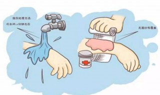 烫伤的处理方法（烫伤后怎么办）