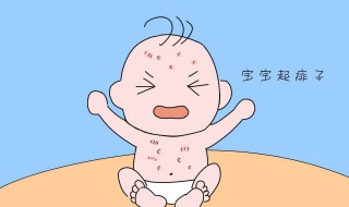 去痱子的最快方法 消除痱子的小妙招