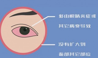 右眼跳代表什么 男人右眼跳代表什么