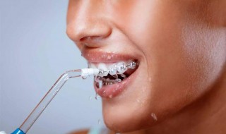 冲牙器正确使用方法 冲牙器正确使用方法图片