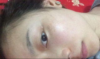 斑怎样才能清除（斑怎么去除简单方法）
